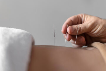 acupuncturist in mississauga